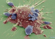 癌细胞喜欢吃什么？90%的人不知道的癌症秘密！ 