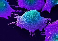 换个角度对付癌症细胞：不能让癌细胞“凑合着吃”