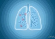 《Nature》七篇连发！肺癌研究重大突破！科学家绘制出肺癌进化分子画像，肺癌诊疗或迎新变革