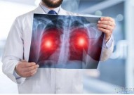 罕见肺癌的靶向治疗：现状、挑战和前景