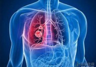 Cancer Cell：肺腺癌倾向于特定器官转移的临床病理学和基因组学特征