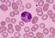 Cell：中性粒细胞助力肿瘤T细胞免疫疗法