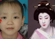 孩子太漂亮也可能是罕见病，歌舞伎综合征