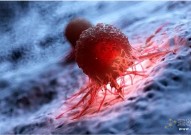 Cell Stem Cell：胆固醇清除疗法或可作为阻断肺癌祖细胞扩增的策略