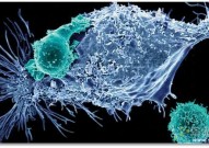 Cell：一种疫苗增强的工程化T细胞反应或能帮助清除人类的实体瘤