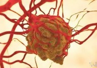 Cancer Cell：利用AAV为载体调整血管表型可促进神经胶质瘤的抗肿瘤免疫