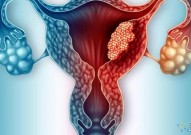 我国首部宫颈癌HPV预防专家共识出炉，所有女性不得不看！