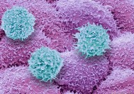 Nature：这一次我们也许走对了！增强抗癌T细胞的CAR-T疗法